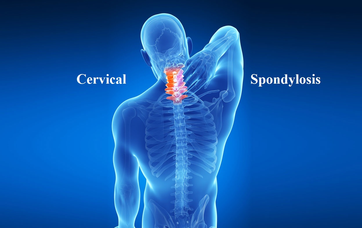 Cervical Spondylosis Which Doctor To See